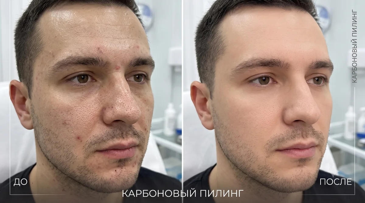 Мужская косметология — фото 1