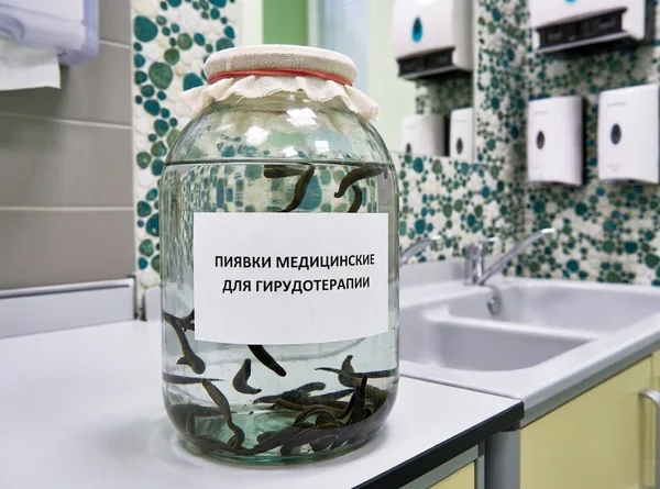 Гирудотерапия — фото 1